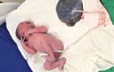 ses maternidade de patos realiza mais um parto de lotus (2).jpg