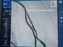 Hemodinâmica gerenciada pela PB Saúde realiza procedimento endovascular inédito em paciente renal 3.jpeg