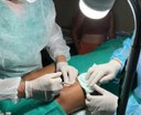 Nesta quarta-feira foram realizados 32 pquenas cirurgias no Hospital de Catolé.jpg