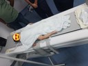 A criança AC de dois anos realizou o exame nesta segunda-feira (16) sendo acompanhada por um anestesista.jpg