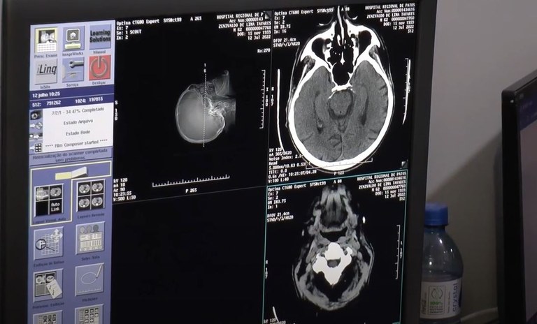 As imagens do novo tomográfo são muito mais precisas.JPG