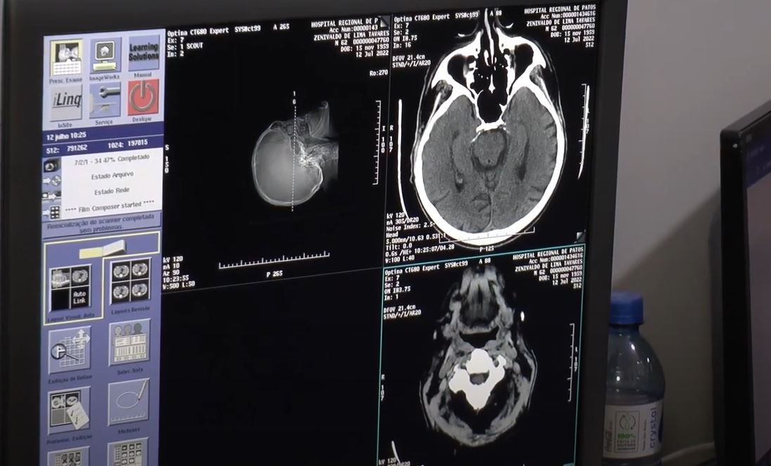 As imagens do novo tomográfo são muito mais precisas.JPG