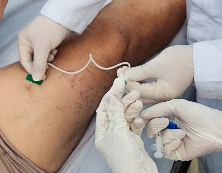 Vascular_aplicação_espuma_dr Rodrigo (2) close (1).jpg
