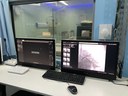 Mais moderno aparelho de hemodinâmica entre unidades privadas e públicas da Paraíba está à disposição do SUS no Hospital Metropolitano 3.JPG