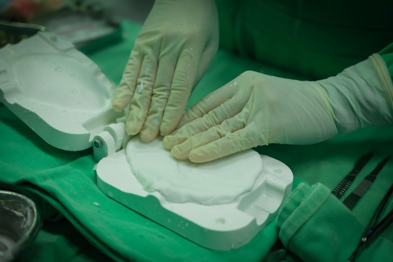 cranioplastia com prótese prototipada (5).jpeg
