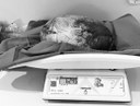 Hospital Regional de Guarabira realiza cirurgia de urgência para retirada de cisto ovariano gigante 2.jpeg