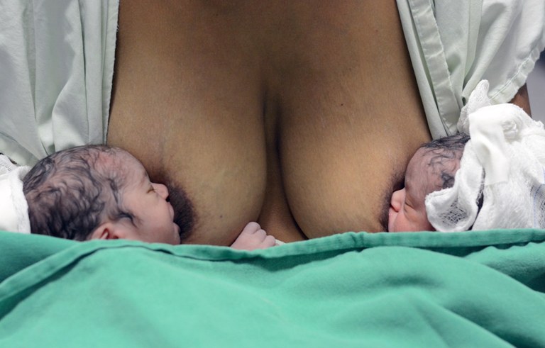 ses hosp geral de mamanguape pais se surpreendem com o nascimento de gemeos (1).jpg