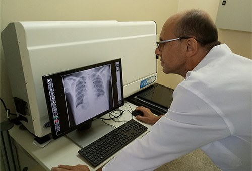 Novo equipamento otimiza diagnóstico por imagem no Clementino Fraga Novo equipamento otimiza diagnóstico por imagem no Clementino Fraga